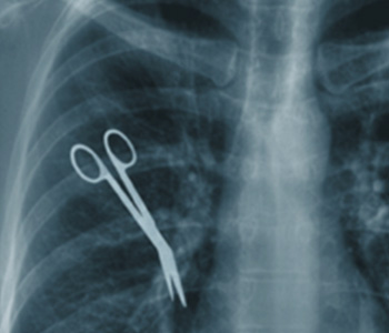 Dental Malpractice